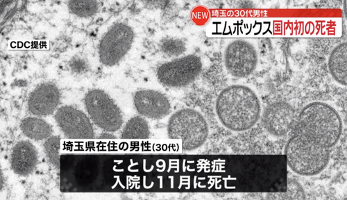 日本出现首例猴痘死亡病例！日本厚劳省发出呼吁！