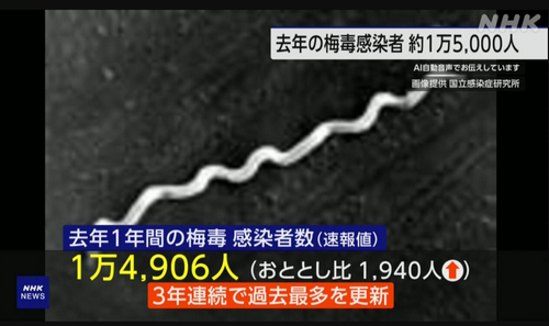 日本去年梅毒感染爆了！14906人中标……